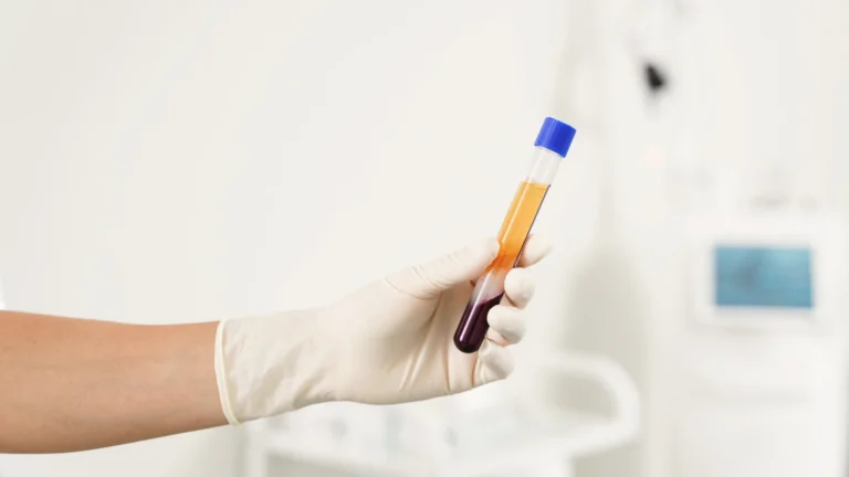 PRP (Platelet-Rich Plasma) (3)